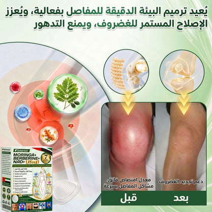 🍀متجر رسمي | 🍋 سولاروزا® مورينجا وبربيرين 10 في 1، أداة نانو ميكرو إبر متقدمة، بطاقة واحدة (مرة يوميًا، تظهر التغييرات المرئية خلال 7 أيام) ✅ السمنة، السكري، انقطاع النفس أثناء النوم، ومشاكل المفاصل