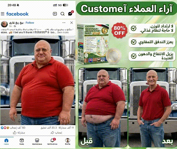 🍀متجر رسمي | 🍋 سولاروزا® مورينجا وبربيرين 10 في 1، أداة نانو ميكرو إبر متقدمة، بطاقة واحدة (مرة يوميًا، تظهر التغييرات المرئية خلال 7 أيام) ✅ السمنة، السكري، انقطاع النفس أثناء النوم، ومشاكل المفاصل