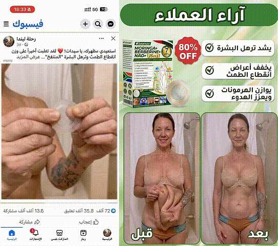 🍀متجر رسمي | 🍋 سولاروزا® مورينجا وبربيرين 10 في 1، أداة نانو ميكرو إبر متقدمة، بطاقة واحدة (مرة يوميًا، تظهر التغييرات المرئية خلال 7 أيام) ✅ السمنة، السكري، انقطاع النفس أثناء النوم، ومشاكل المفاصل