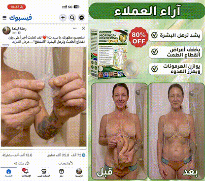 🍀متجر رسمي | 🍋 سولاروزا® مورينجا وبربيرين 10 في 1، أداة نانو ميكرو إبر متقدمة، بطاقة واحدة (مرة يوميًا، تظهر التغييرات المرئية خلال 7 أيام) ✅ السمنة، السكري، انقطاع النفس أثناء النوم، ومشاكل المفاصل